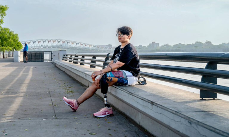 A person with a prosthetic leg sitting near a river front